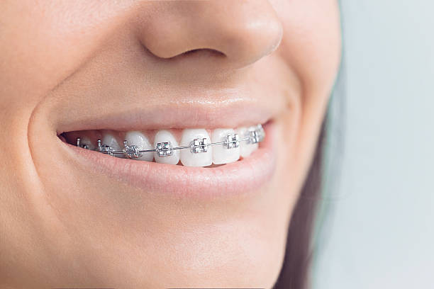 Best Wisdom Tooth Removal  in Samoset, FL